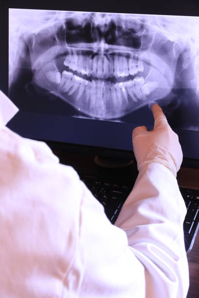 Best Broken or Chipped Tooth Repair in Liverpool, NY